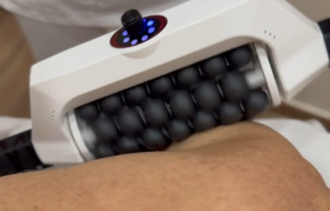 Dermaroller | Etica & Estetica