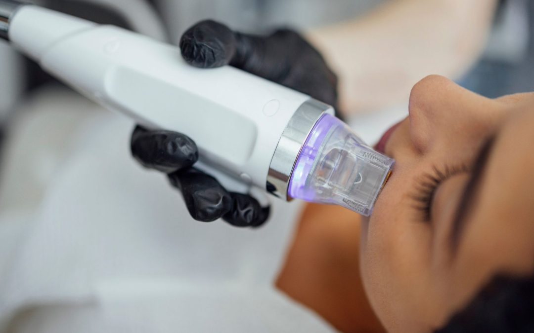 Microneedling | Etica & Estetica