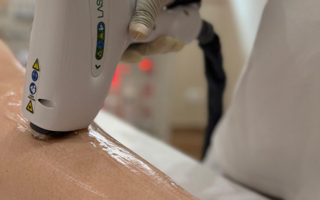 Epilazione Laser | Etica & Estetica