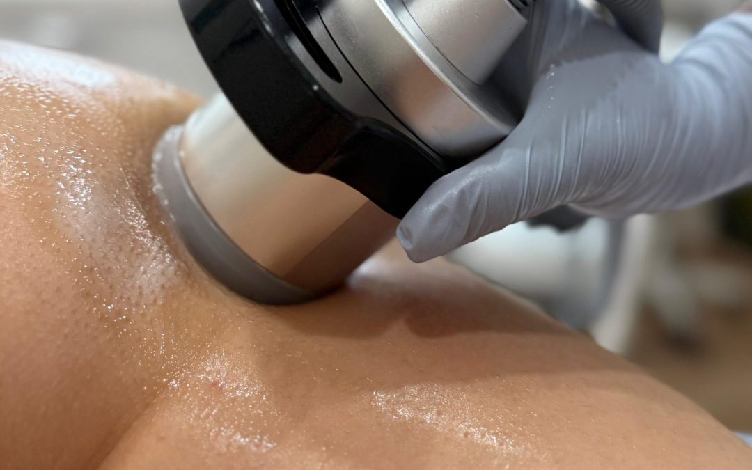 Radiofrequenza Vacuum | Etica & Estetica